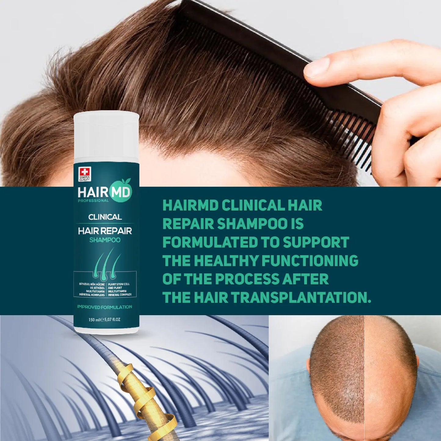 HairMD Clinical Hair Repair Shampoo 150 ml Eksklusiv anti-hårtap-sensitiv sjampo